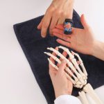 26955872 – hand surgeon explaining a patient his injury